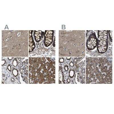 Immunohistochemistry-Paraffin NDUFV3 Antibody - BSA Free