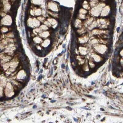 <b>Independent Antibodies Validation. </b>Immunohistochemistry-Paraffin: NDUFV3 Antibody [NBP1-85623] - Staining of human colon.