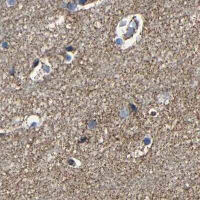 Immunohistochemistry-Paraffin: NDUFV3 Antibody [NBP1-85623] - Staining of human cerebral cortex.