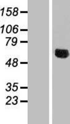 Western Blot: NDUFV3 Overexpression Lysate (Adult Normal) [NBL1-13568] Left-Empty vector transfected control cell lysate (HEK293 cell lysate); Right -Over-expression Lysate for NDUFV3.