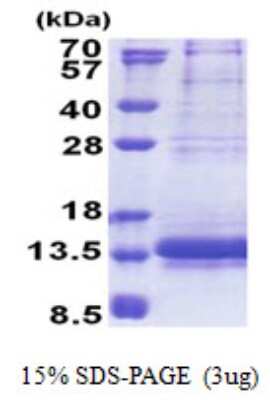 SDS-PAGE Recombinant Human NDUFV3 His Protein