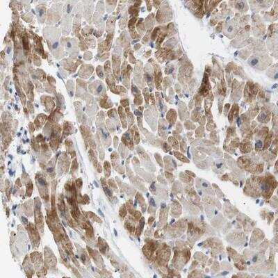 Immunohistochemistry NEBL Antibody - BSA Free
