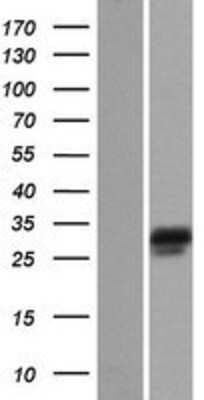 Western Blot: NEBL Overexpression Lysate (Adult Normal) [NBP2-04475] Left-Empty vector transfected control cell lysate (HEK293 cell lysate); Right -Over-expression Lysate for NEBL.