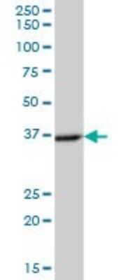 Western Blot: NECAP2 Antibody [H00055707-B01P] - Analysis of NECAP2 expression in human stomach.