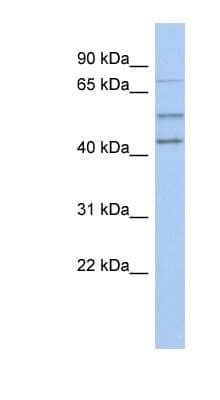 Western Blot: NEDD1 Antibody [NBP1-55320] - Titration: 0.2-1 ug/ml, Positive Control: Human Spleen.