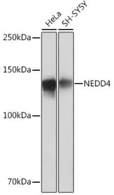 Western Blot: NEDD4 Antibody (7R0M4) [NBP3-16398] - Western blot analysis of extracts of various cell lines, using NEDD4 Rabbit mAb (NBP3-16398) at 1:1000 dilution. Secondary antibody: HRP Goat Anti-Rabbit IgG (H+L) at 1:10000 dilution. Lysates/proteins: 25ug per lane. Blocking buffer: 3% nonfat dry milk in TBST. Detection: ECL Basic Kit. Exposure time: 1s.