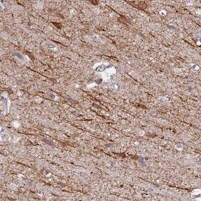 Immunohistochemistry-Paraffin: NEDD4 Antibody [NBP1-83044] - Staining of human cerebral cortex shows distinct cytoplasmic positivity in subsets of neuronal cells.