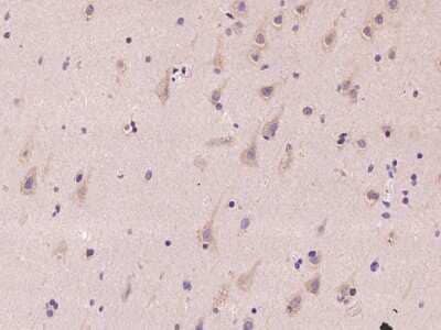 Immunohistochemistry-Paraffin: NEDD4 Antibody [NBP2-97422] - Immunochemical staining of human NEDD4 in human brain with rabbit polyclonal antibody at 1:100 dilution, formalin-fixed paraffin embedded sections.