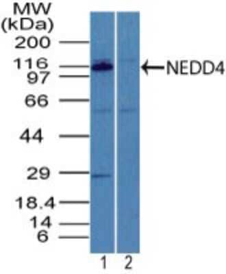 Western Blot: NEDD4 Antibody [NBP2-27201] - Analysis of NEDD4 in mouse embryo brain tissue lysate in the 1) absence and 2) presence of immunizing peptide using NBP2-27201. Goat anti-rabbit Ig HRP secondary antibody and PicoTect ECL substrate solution were used for this test.