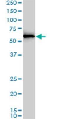Western Blot: NEDD8 Activating Enzyme (APPBP1/UBA3) Antibody (4E8-H3) [H00008883-M01] - APPBP1 monoclonal antibody (M01), clone 4E8-H3. Analysis of APPBP1 expression in A-431.