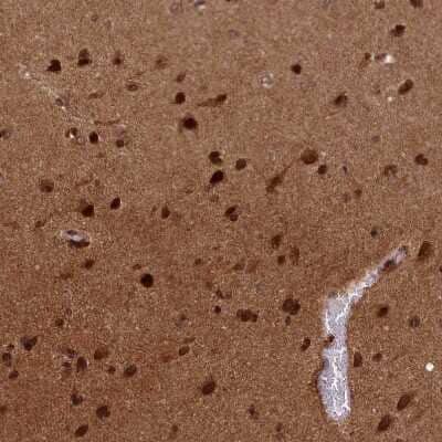 Immunohistochemistry-Paraffin: NEDD8 Activating Enzyme (APPBP1/UBA3) Antibody [NBP1-92163] - Staining of human cerebral cortex shows strong nuclear positivity in neurons.