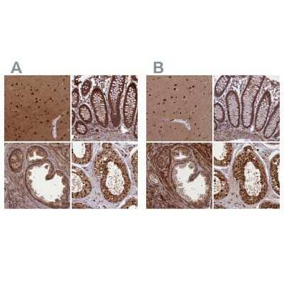 <b>Independent Antibodies Validation. </b>Immunohistochemistry-Paraffin: NEDD8 Activating Enzyme (APPBP1/UBA3) Antibody [NBP1-92163] - Staining of human cerebral cortex, colon, prostate and testis using Anti-NAE1 antibody NBP1-92163 (A) shows similar protein distribution across tissues to independent antibody NBP1-92162 (B).