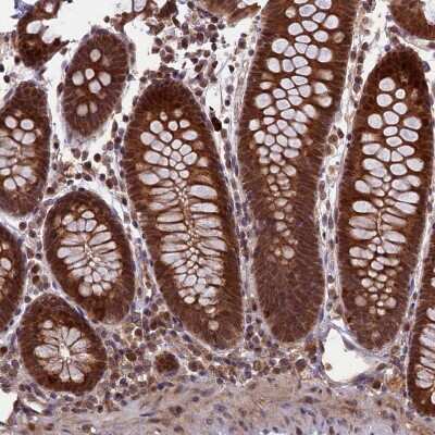 Immunohistochemistry-Paraffin: NEDD8 Activating Enzyme (APPBP1/UBA3) Antibody [NBP1-92163] - Staining of human colon shows strong nuclear positivity in glandular cells.