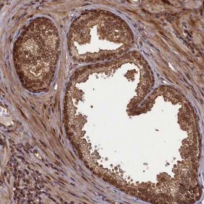 Immunohistochemistry-Paraffin: NEDD8 Activating Enzyme (APPBP1/UBA3) Antibody [NBP1-92163] - Staining of human prostate shows strong nuclear positivity in glandular cells.