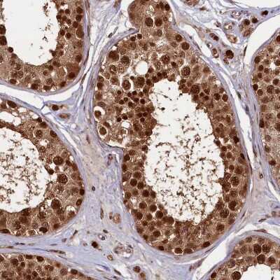 <b>Independent Antibodies Validation. </b>Immunohistochemistry-Paraffin: NEDD8 Activating Enzyme (APPBP1/UBA3) Antibody [NBP1-92163] - Staining of human testis shows strong nuclear positivity in cells in seminiferous ducts.