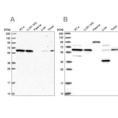 APPBP1 Antibody (NBP1-92162): Novus Biologicals