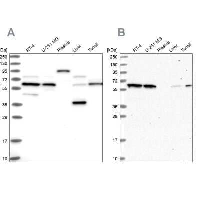 Western Blot: NEDD8 Activating Enzyme (APPBP1/UBA3) Antibody [NBP1-92163] - Analysis using Anti-NAE1 antibody NBP1-92163 (A) shows similar pattern to independent antibody NBP1-92162 (B).