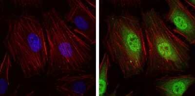 Immunocytochemistry/Immunofluorescence: NEDD8 Antibody (1A7) [NBP2-37524] - Immunofluorescence analysis of Hela cells using NEDD8 mouse mAb (green). Blue: DRAQ5 fluorescent DNA dye. Red: Actin filaments have been labeled with Alexa Fluor-555 phalloidin.