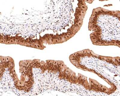 Immunohistochemistry-Paraffin: NEDD8 Antibody (JF69-09) [NBP2-66970] - Analysis of paraffin-embedded rat bladder tissue with Rabbit anti-NEDD8 antibody washed with ddH2O and PBS, and then probed with the primary antibody  at 1/400 dilution for 1 hour at room temperature. The detection was performed using an HRP conjugated compact polymer system. DAB was used as the chromogen. Tissues were counterstained with hematoxylin and mounted with DPX.