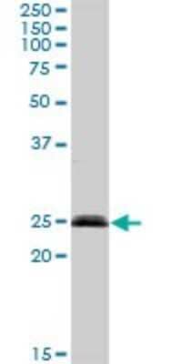 Western Blot: NEDP1/SENP8 Antibody [H00123228-D01P] - Analysis of SENP8 expression in human liver.