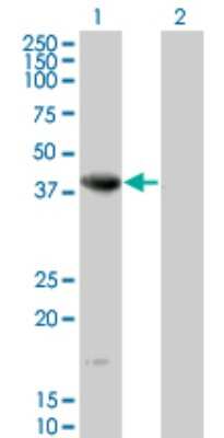 Western Blot: NEIL2 Antibody (1B7) [H00252969-M01] - Analysis of NEIL2 expression in transfected 293T cell line by NEIL2 monoclonal antibody (M01), clone 1B7.Lane 1: NEIL2 transfected lysate(36.8 KDa).Lane 2: Non-transfected lysate.