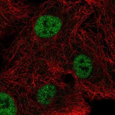 Immunocytochemistry/Immunofluorescence: NEIL2 Antibody [NBP2-68948] - Staining of human cell line A549 shows localization to nucleoplasm & vesicles.