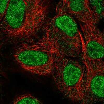 Immunocytochemistry/Immunofluorescence: NEIL2 Antibody [NBP2-68972] - Staining of human cell line A549 shows localization to nucleoplasm. Antibody staining is shown in green.