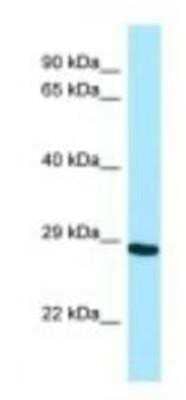 Western Blot: NEIL2 Antibody [NBP1-98526] - THP-1 Cell Lysate 1.0ug/ml, Gel Concentration: 12%