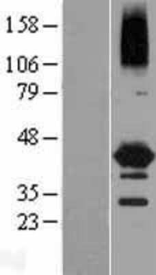 Western Blot: NEIL2 Overexpression Lysate (Adult Normal) [NBL1-13580] Left-Empty vector transfected control cell lysate (HEK293 cell lysate); Right -Over-expression Lysate for NEIL2.