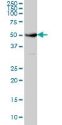 Western Blot: NEK10 Antibody (1C9) [H00152110-M01] - NEK10 monoclonal antibody (M01), clone 1C9 Analysis of NEK10 expression in HeLa.