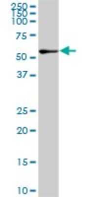 Western Blot: NEK10 Antibody (1C9) [H00152110-M01] - NEK10 monoclonal antibody (M01), clone 1C9. Analysis of NEK10 expression in NIH/3T3.