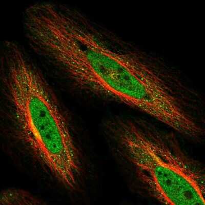 Immunocytochemistry/ Immunofluorescence NEK10 Antibody