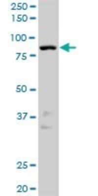 Western Blot NEK10 Antibody