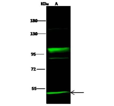 Western Blot: NEK10 Antibody [NBP2-99009] - Anti-NEK10 rabbit polyclonal antibody at 1:500 dilution. Lane A: A431 Whole Cell Lysate. Lysates/proteins at 30 ug per lane. Secondary Goat Anti- Rabbit IgG H&L (Dylight 800) at 1/10000 dilution. Developed using the Odyssey technique. Performed under reducing conditions. Predicted band size: 53 kDa. Observed band size: 53 kDa (We are unsure as to the identity of these extra bands).