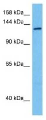 Western Blot: NEK10 Antibody [NBP3-10139] - Western blot analysis of NEK10 in Mouse Kidney lysates. Antibody dilution at 1ug/ml