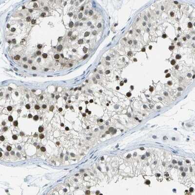 Immunohistochemistry-Paraffin: NEK11 Antibody [NBP1-83584] - Staining of human testis shows strong nuclear positivity in subsets of cells in ductus seminiferus.