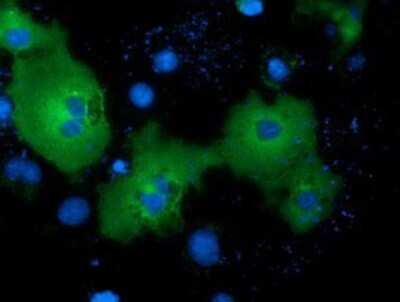 Immunocytochemistry/Immunofluorescence: NEK11 Antibody (OTI4H5) - Azide and BSA Free [NBP2-72933] - Staining of COS7 cells transiently transfected by pCMV6-ENTRY NEK11.