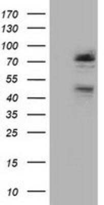 Western Blot: NEK11 Antibody (OTI4H5) - Azide and BSA Free [NBP2-72933] - HEK293T cells were transfected with the pCMV6-ENTRY control (Left lane) or pCMV6-ENTRY NEK11 (Right lane) cDNA for 48 hrs and lysed. Equivalent amounts of cell lysates (5 ug per lane) were separated by SDS-PAGE and immunoblotted with anti-NEK11.