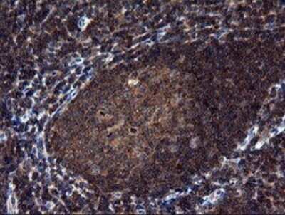 Immunohistochemistry: NEK11 Antibody (OTI5D9) [NBP2-46140] - Analysis of Human tonsil.