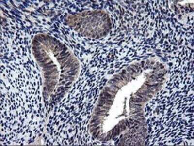 Immunohistochemistry: NEK11 Antibody (OTI5D9) [NBP2-46140] - Analysis of Human endometrium tissue .