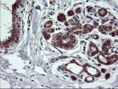 Immunohistochemistry: NEK11 Antibody (OTI5D9) [NBP2-46140] - Analysis of Human breast tissue.