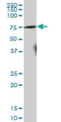 Western Blot: NEK2 Antibody [H00004751-B01P] - Analysis of NEK2 expression in rat brain.