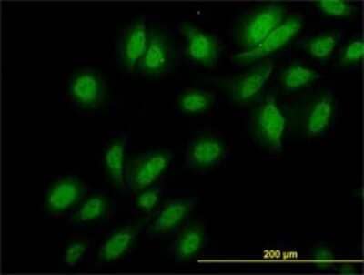 Immunocytochemistry/Immunofluorescence: NEK3 Antibody (2F8) [H00004752-M01] - Analysis of monoclonal antibody to NEK3 on HeLa cell. Antibody concentration 10 ug/ml.