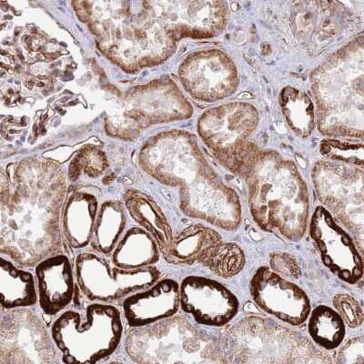 Immunohistochemistry-Paraffin: NEK3 Antibody [NBP2-13649] - Staining of human kidney shows strong cytoplasmic positivity in cells in tubules.
