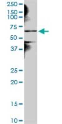 Western Blot: NEK3 Antibody [H00004752-B01P] - Analysis of NEK3 expression in A-431.