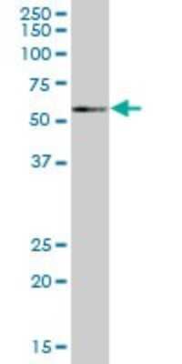 Western Blot: NEK3 Antibody [H00004752-B01P] - Analysis of NEK3 expression in human colon.