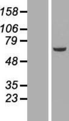 Western Blot: NEK3 Overexpression Lysate (Adult Normal) [NBP2-08110] Left-Empty vector transfected control cell lysate (HEK293 cell lysate); Right -Over-expression Lysate for NEK3.