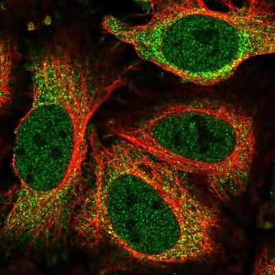 Immunocytochemistry/Immunofluorescence: NEK6 Antibody [NBP2-58672] - Staining of human cell line HeLa shows localization to nucleoplasm & cytosol.