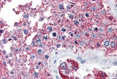 Immunohistochemistry-Paraffin: NEK6 Antibody [NBP3-14415] - Immunohistochemistry of formalin-fixed, paraffin-embedded human testis after heat-induced antigen retrieval.
