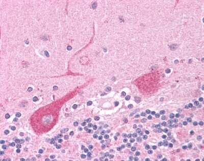 Immunohistochemistry-Paraffin: NEK6 Antibody [NLS7305] - Analysis of anti-NEK6 antibody with human brain, Purkinje neurons at 13 ug/ml.
